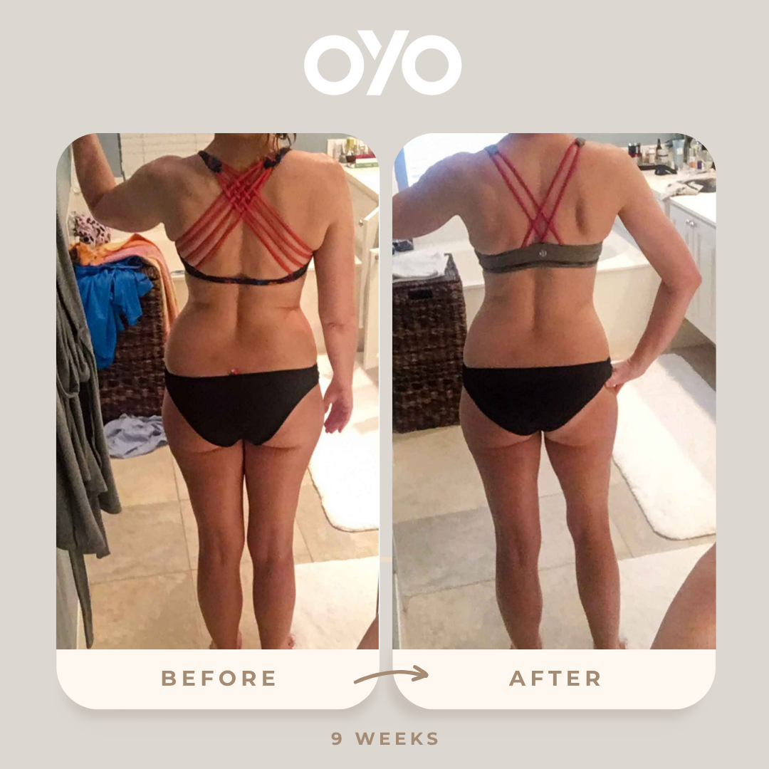 Love my OYO Deluxe Kit.